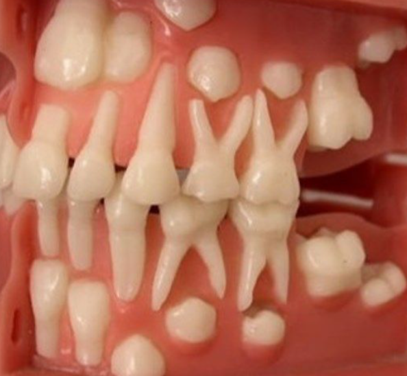 Você conhece a cronologia da dentição humana?