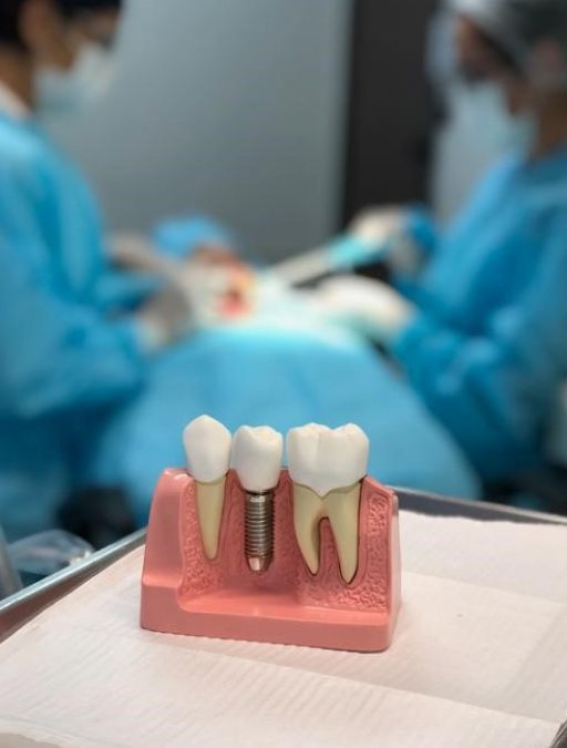 Quem não pode fazer um Implante Dentário?