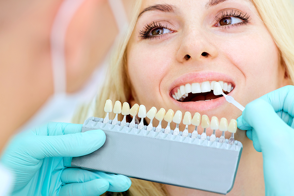 Quem Pode Fazer Clareamento Dentário?